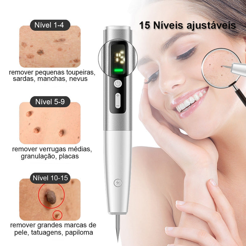 Point Mole Beauty Pen® - A caneta da beleza