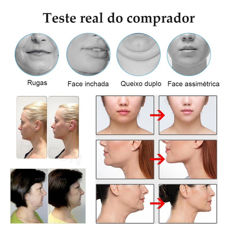 Vex Massager® - Massageador redutor de papada e rugas